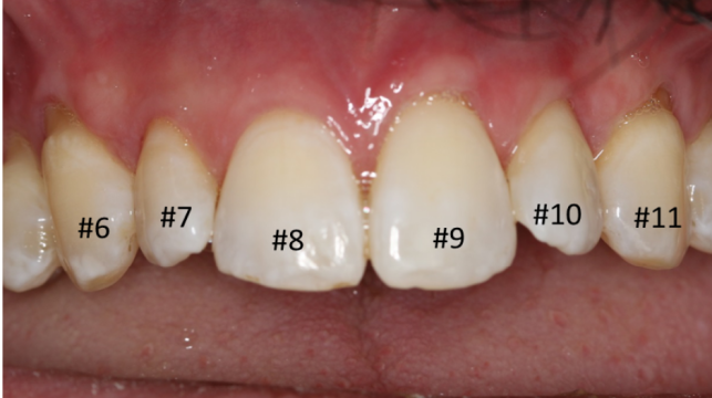 gg1After gg1After
