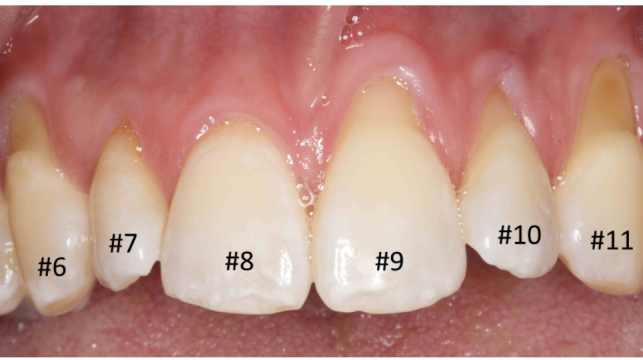 gg1Before gg1Before